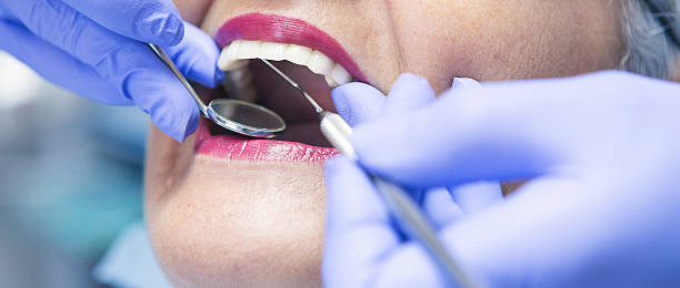 Best Emergency Tooth Extraction in Mabscott, WV